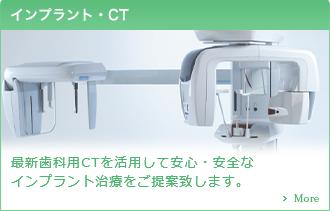 【インプラント・CT】最新歯科用CTを活用して安心・安全なインプラント治療をご提案いたしま。